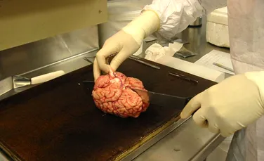 Cum arată cea mai mare bancă de creier din lume. Peste 9.000 de creiere au fost stocate de la înfiinţarea instituţiei – VIDEO