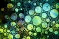 Infecțiile bacteriene, a doua cauză de deces la nivel mondial