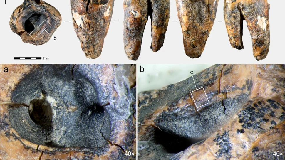Unde practicau neanderthalienii stomatologia acum 60.000 de ani?