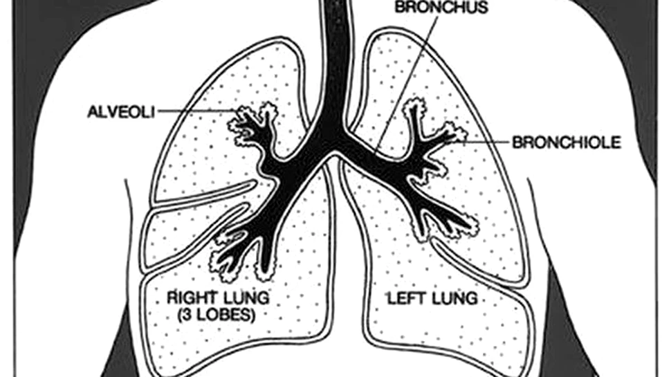 Primul transplant de bronhie artificială, realizat în Franţa