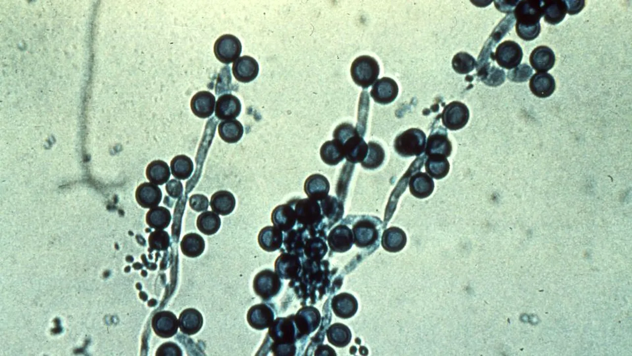 1-candida-albicans 