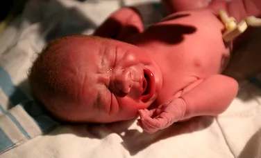 Cercetătorii au descoperit un risc neştiut la adresa sănătăţii bebeluşilor ce vin pe lume prin naştere provocată
