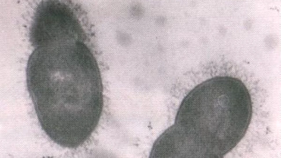 Meningita va fi diagnosticata intr-o ora