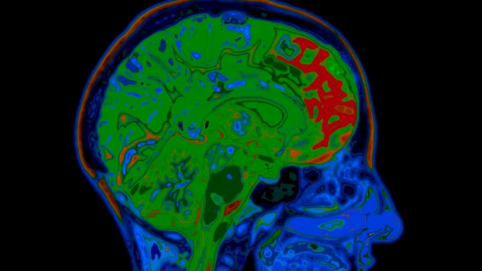 Grasimea abdominală scade volumul creierului
