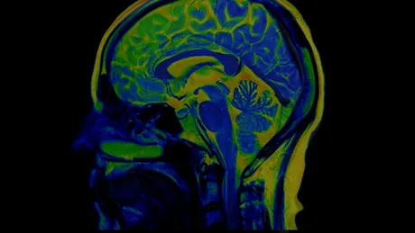 Pentru prima dată, cercetătorii au cartografiat circuitul cerebral prin care stresul afectează somnul și memoria