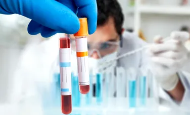 Test de cultură generală. Când a fost făcută prima transfuzie de sânge?