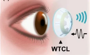 Lentilele de contact inteligente ar putea trata o cauză principală a orbirii