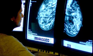 Zeci de mii de femei din Anglia ar putea primi un medicament pentru prevenirea cancerului de sân