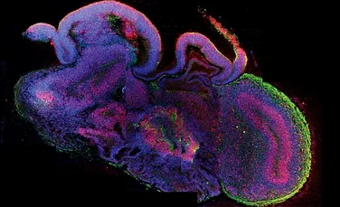 Reuşită remarcabilă, fără precedent: oamenii de ştiinţă au reuşit să creeze un „mini-creier” uman!