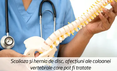 Scolioza și hernia de disc, afecțiuni ale coloanei vertebrale care pot fi tratate (P)