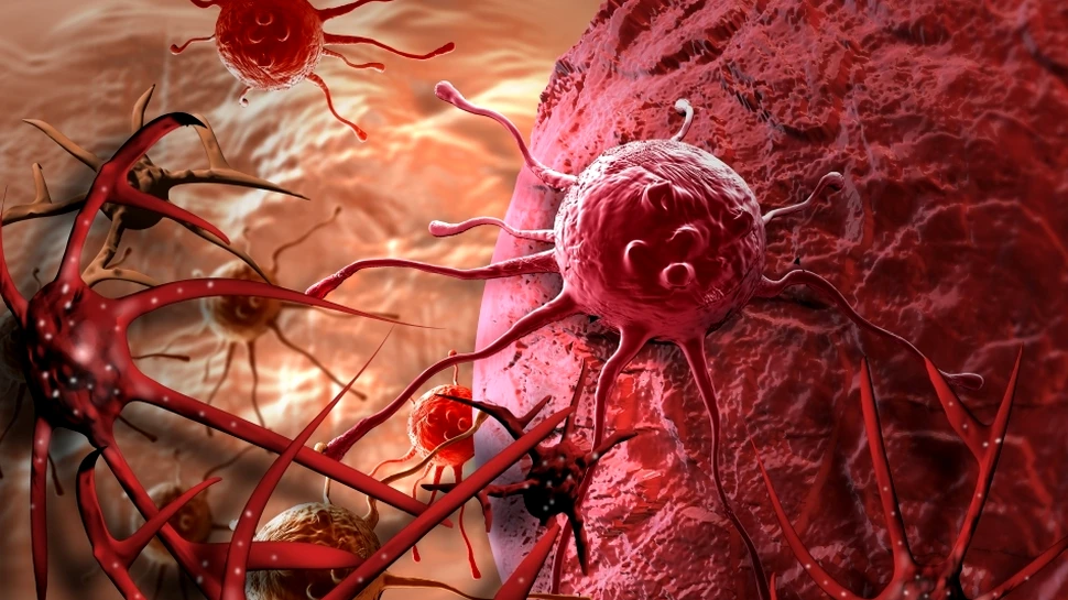 O tehnică inovatoare în lupta contra cancerului ar putea preveni 90% dintre decesele provocate de această teribilă boală
