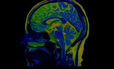 Pentru prima dată, cercetătorii au cartografiat circuitul cerebral prin care stresul afectează somnul și memoria