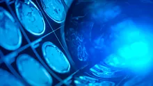 Test de cultură generală. Ce importanță medicinală are heliul?