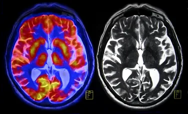 O sondă de mare rezoluție ar putea dezvălui secretele funcției creierului și ale bolilor neurologice