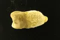 Bacteria scarlatinei a fost găsită într-o mumie precolumbiană. De ce contează descoperirea?