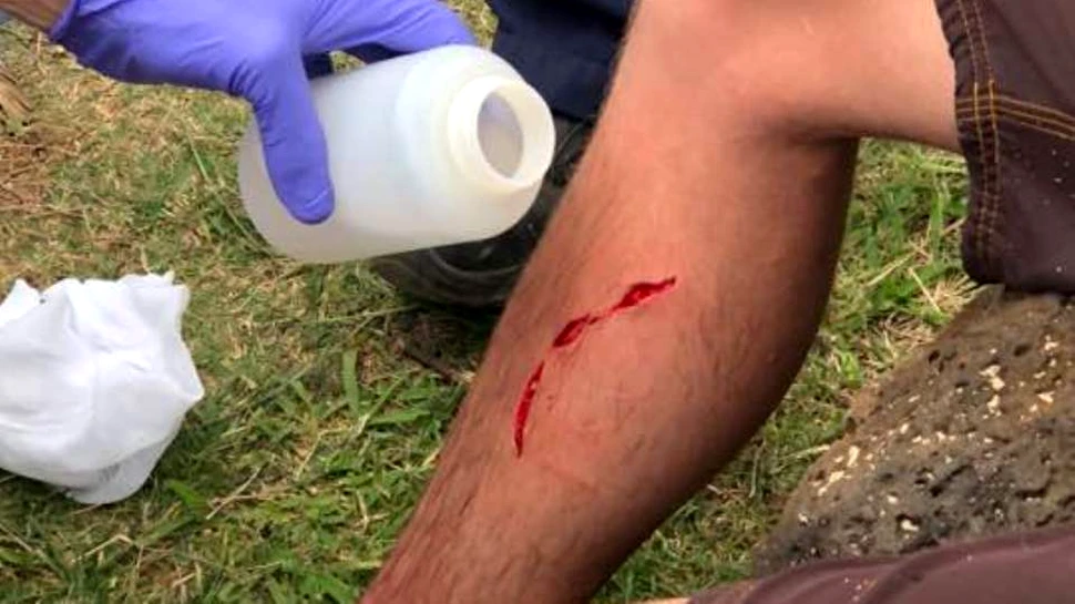 ”Ori sunt foarte norocos, ori foarte ghinionist”. Un om ”greu de ucis” a fost muşcat de rechin, urs şi şarpe