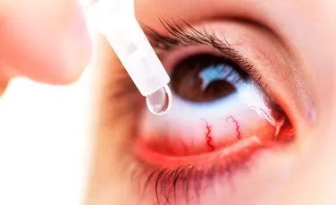 Picături pentru ochi care ar putea înlocui ochelarii de citit, aprobate de FDA