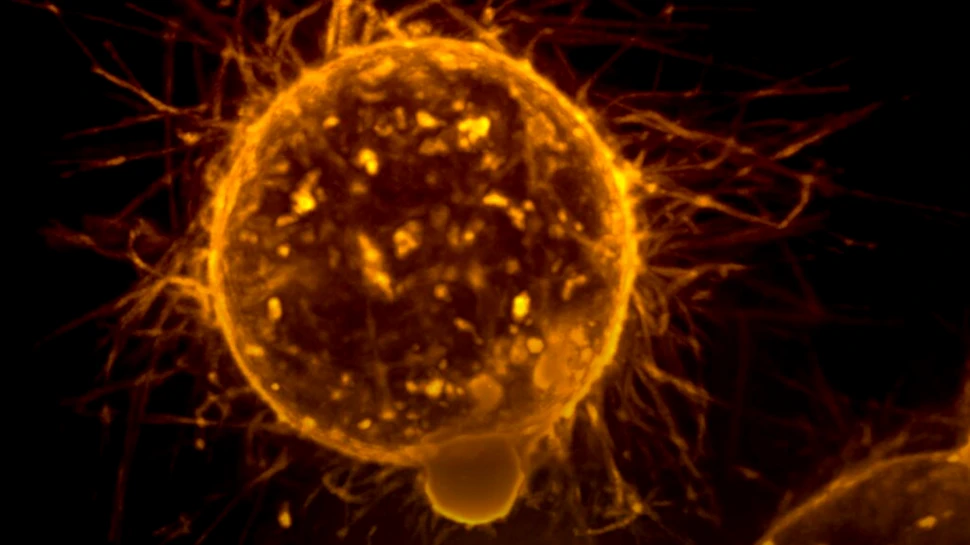 Bacteria controlată prin sunete ar putea fi un nou mod de a trata cancerul