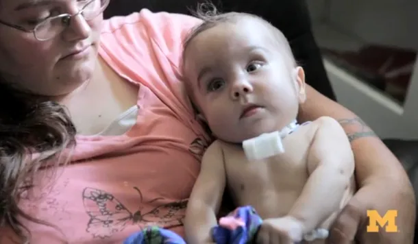 Imprimantele 3D salvează vieţi: un bebeluş a supravieţuit mulţumită unui dispozitiv medicat printat 3D