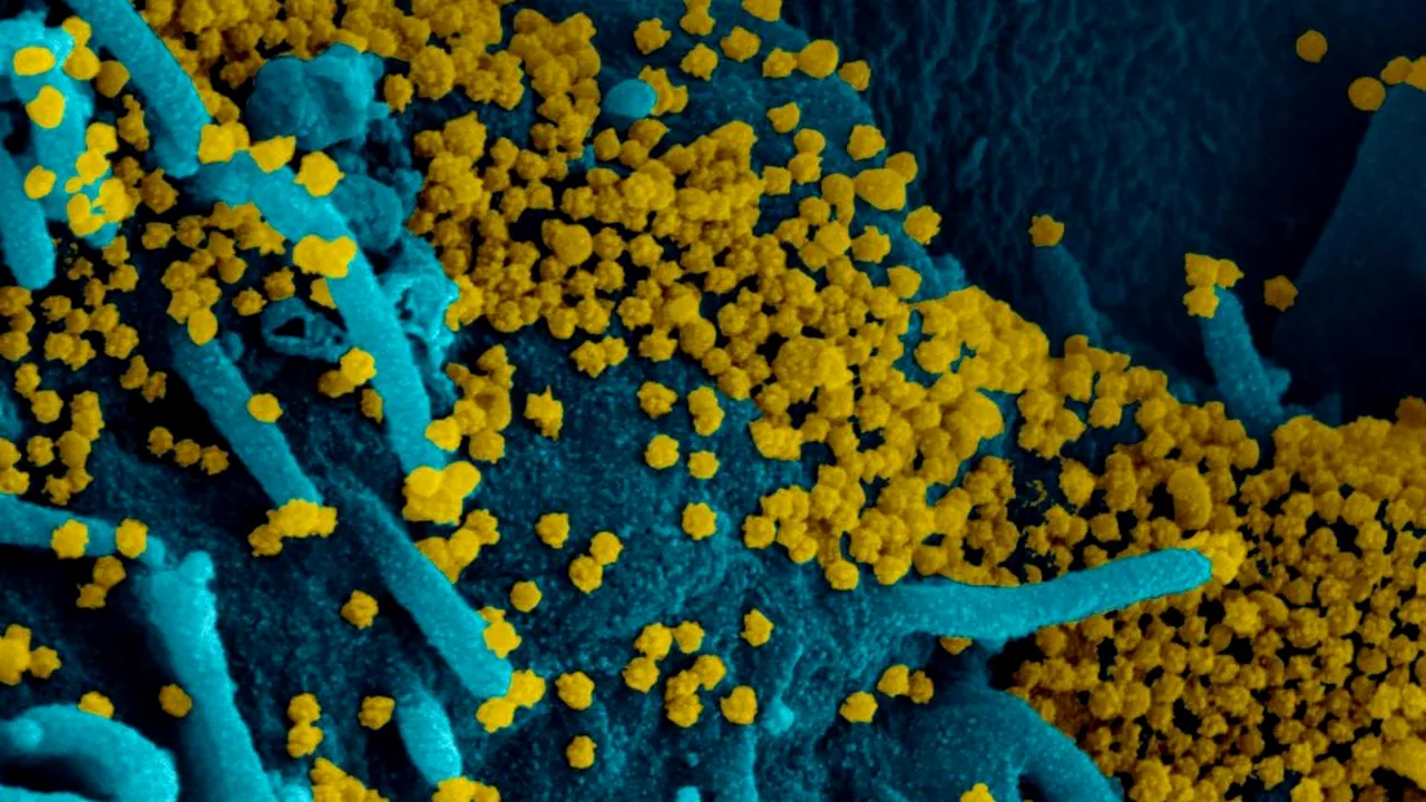 coronavirus-covid-virus-NIAID_descopera 
