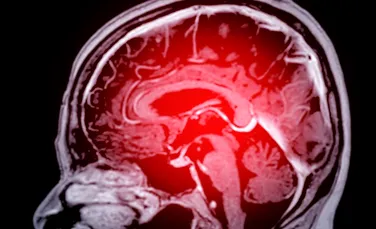 Microbiomul creierului ar putea ajuta la prevenirea demenței?
