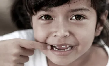 Cum distrug părinţii dinţii copiilor dându-le „alimente sănătoase”