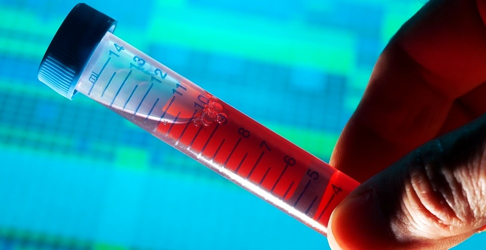 Un nou test sangvin poate să detecteze cancerul oral cauzat de virusul papiloma uman (HPV)