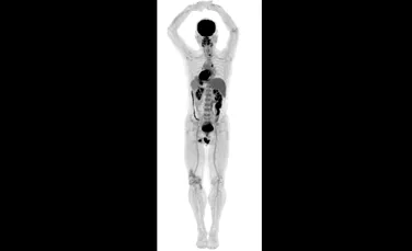 Prima imagine cu un om a lui EXPLORER, scannerul ce realizează în câteva secunde o tomografie 3D a întregului corp