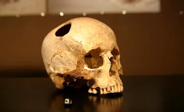 Analizarea a 800 de cranii scoate la iveală faptul că medicii din Imperiul Incaş erau mai buni decât cei din timpul Războiului Civil American