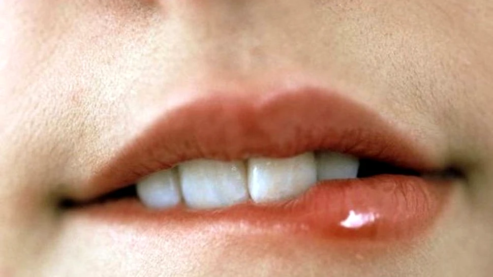 Ce daune poate provoca herpesul la nivelul creierului – VIDEO