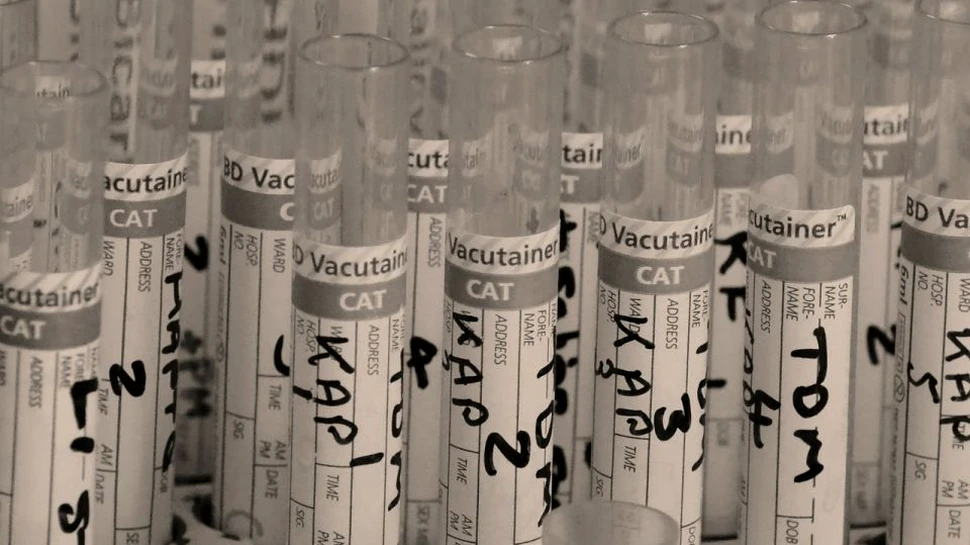 Un proiect al Armatei SUA care implica studierea patogenilor a fost oprit din cauza nerespectării normelor de siguranţă