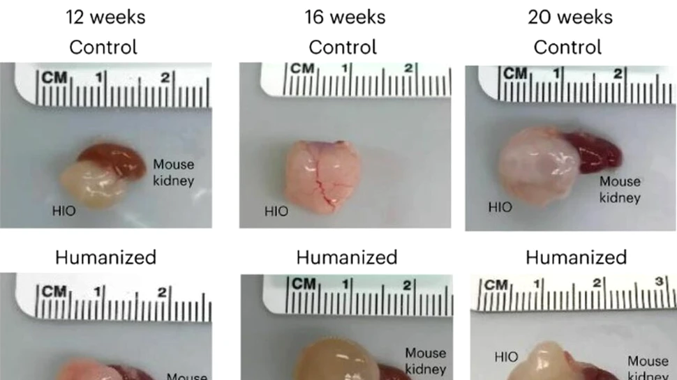 Mini-intestine umane, parțial funcționale, au fost crescute în șoareci