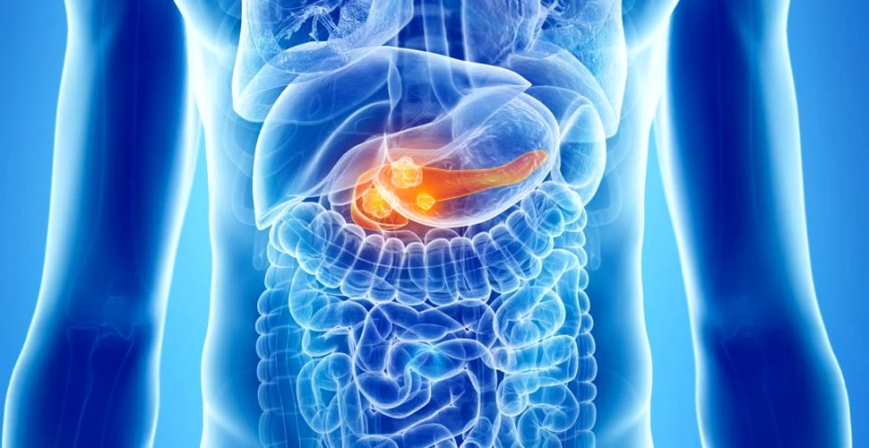 Cancerul de pancreas poate fi tratabil cu ajutorul unei metode inedite