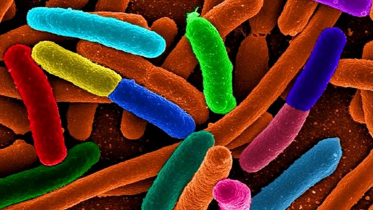 2-diverse-e-coli 