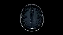 Un test de sânge îi poate ajuta pe medici să identifice mai bine severitatea leziunilor cerebrale