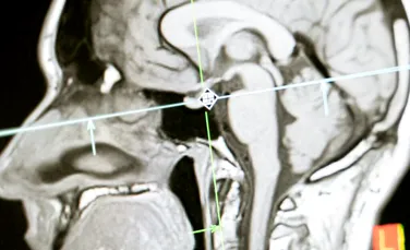 Rasa umană, prezisă de inteligența artificială pe baza radiografiilor. De ce îi neliniștește asta pe cercetători?