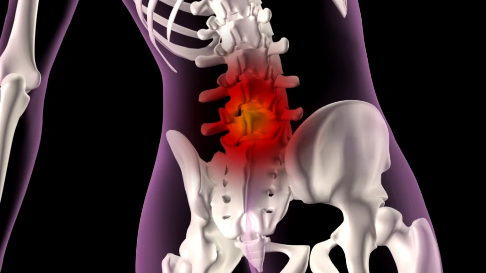 Descoperire „demnă de premiul Nobel”: o nouă metodă de a trata cu succes durerile de spate