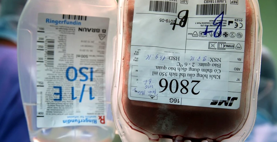 Transfuziile de sânge ar putea reduce daunele cauzate de către atacurile vasculare cerebrale