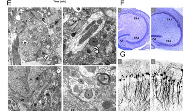 Poate fi readus la viață un creier crioconservat? Iată ce au arătat noi experimente!
