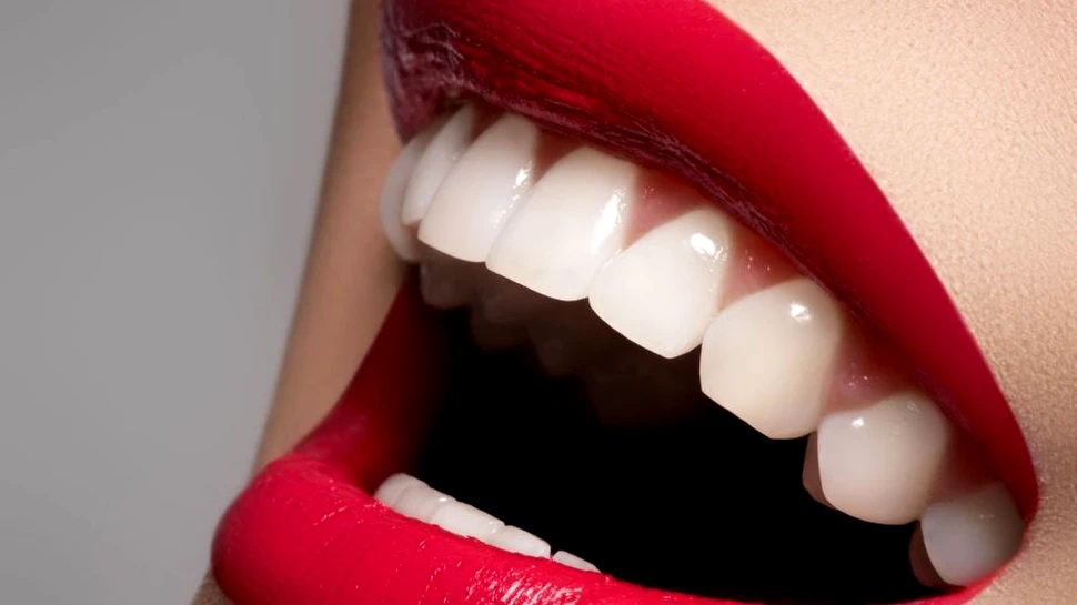 Implantul dentar ceramic, o nouă inovaţie în România. Mituri despre implantul dentar