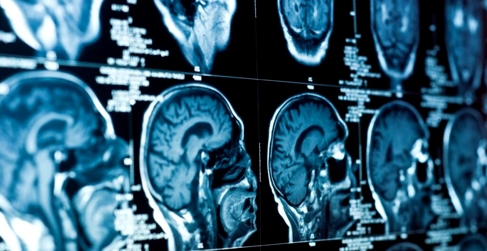 Aciditatea creierului, legată de unele tulburări neurologice
