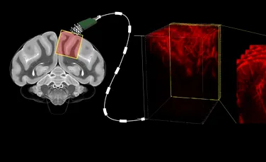 Citirea creierului uman prin ultrasunete este posibilă. Ar putea revoluționa tehnologia interfață creier-computer