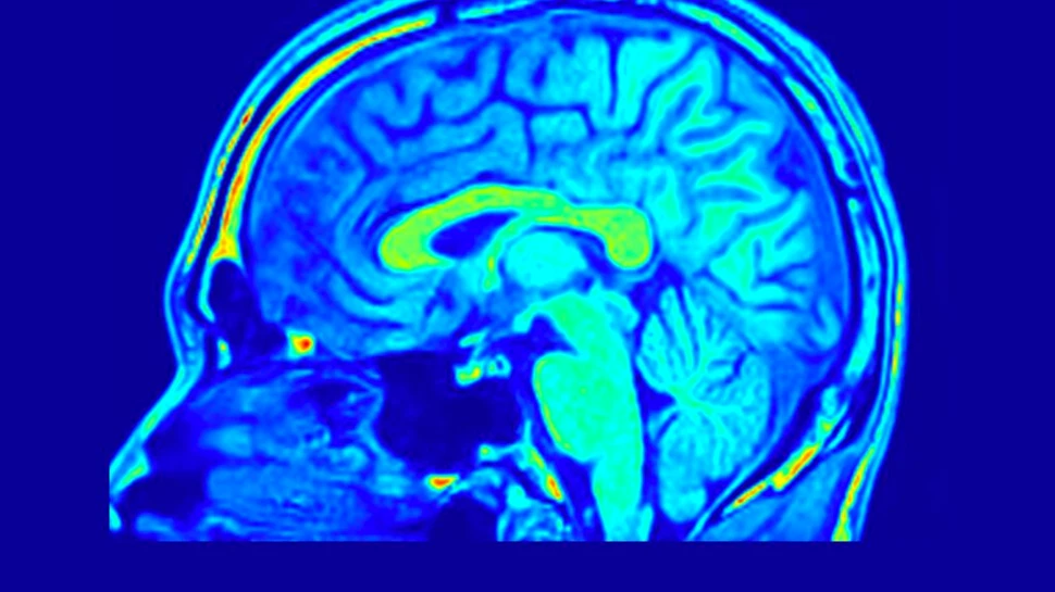 Cercetătorii vor să afle cum formează creierul iluzii cu ajutorul laserelor