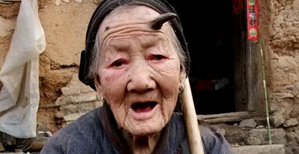Unei chinezoaice centenare i-a crescut un corn in frunte (FOTO)