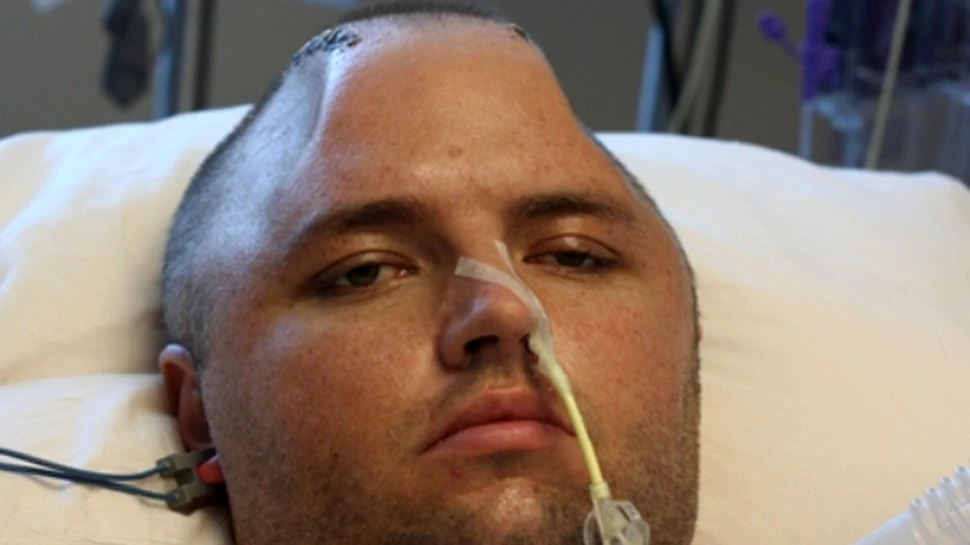 I-au salvat viata extirpandu-i si congelandu-i craniul