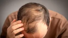 Oamenii de știință au descoperit o proteină care ar putea ajuta la inversarea căderii părului