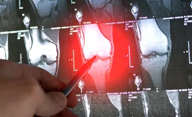 Un studiu major vrea să afle dacă supraviețuitorii cancerului sunt „super-oameni”
