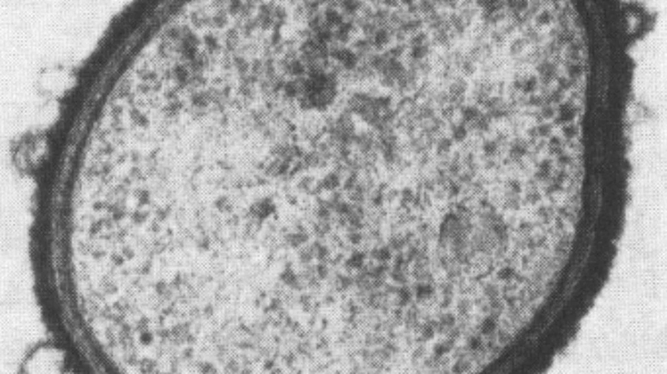 Un microb te scapa de ulcer