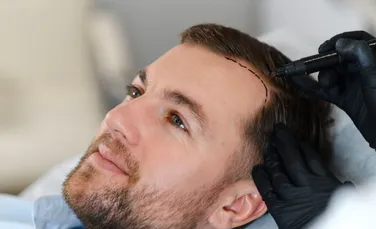 Foliculi de păr complet funcționali au fost cultivați în laborator pentru prima dată. La ce ar putea fi folosiți?