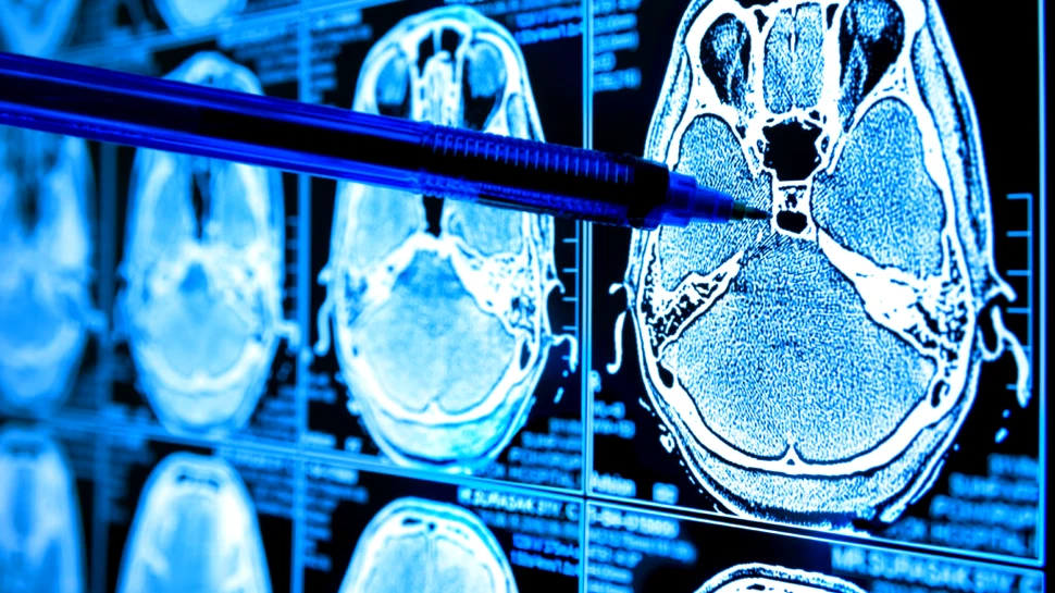 Un simplu test de sânge ar putea diagnostica boala Alzheimer